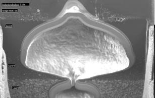 focus ion beam klein